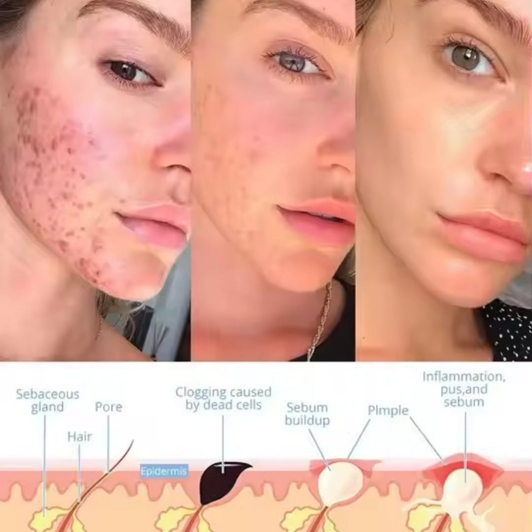 Zapra™ - Facial Wand